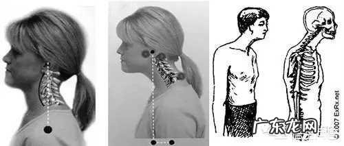 富贵包,最佳处理方式是穴位按摩,对此,你认可吗?