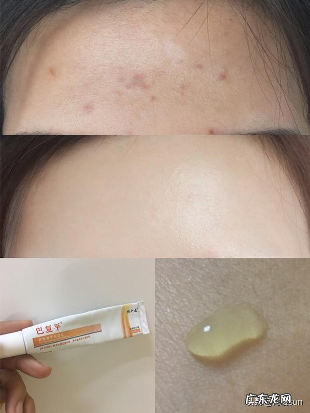 如何修复脸上皮肤的各种问题?