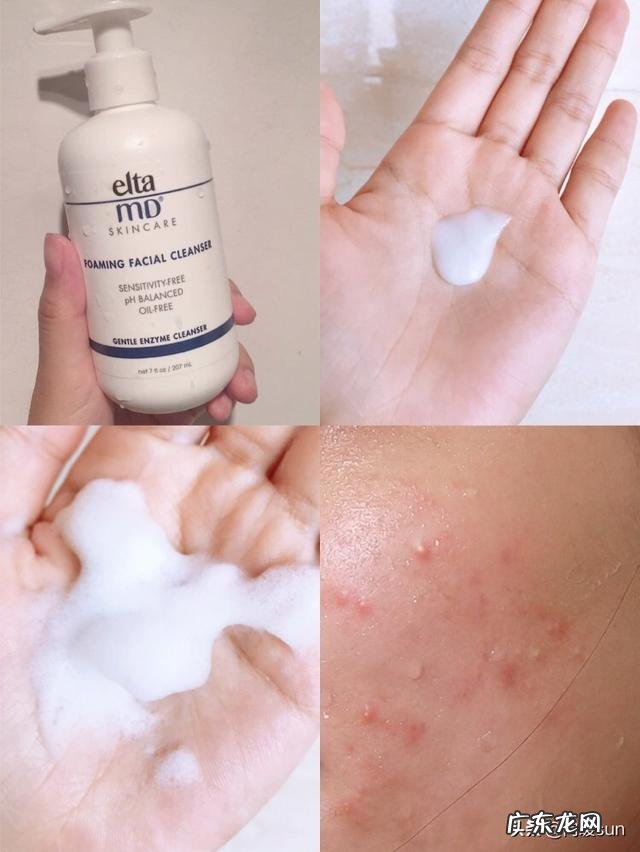 如何修复脸上皮肤的各种问题?