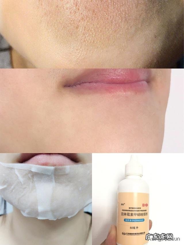 如何修复脸上皮肤的各种问题?