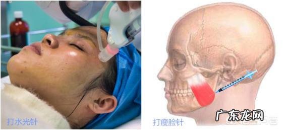 瘦脸针和水光针可以同时打吗?