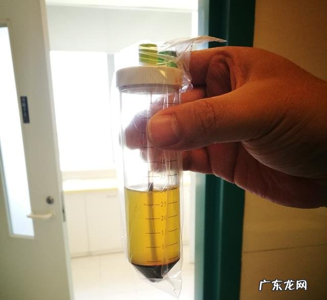 更年期会造成关节疼吗?更年期过后就不疼了吗?