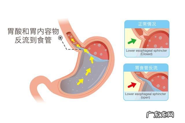 晚上睡觉口干是怎么回事？