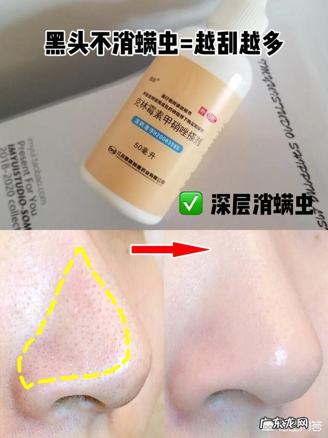 我的皮肤总是油油的,请问大家有人知道怎么办嘛?