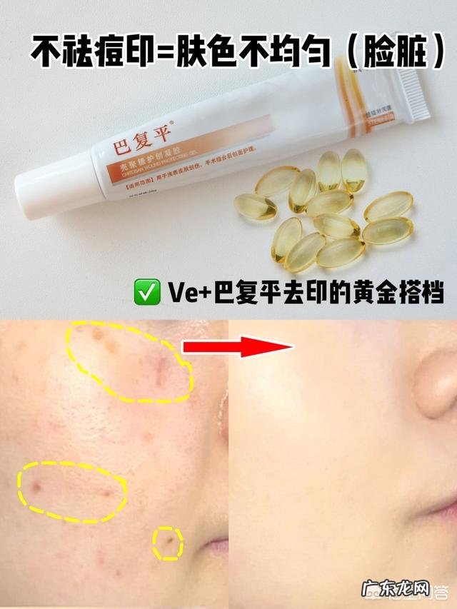 我的皮肤总是油油的,请问大家有人知道怎么办嘛?