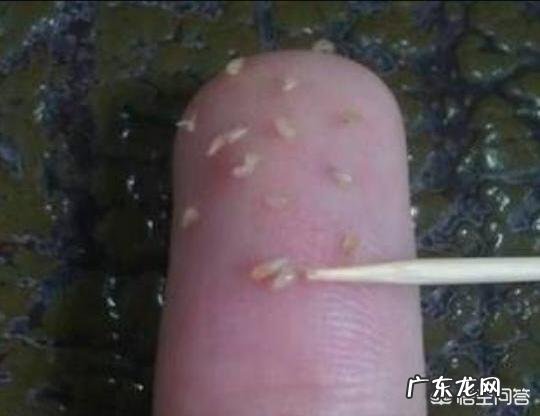 毛孔里的油脂分泌物为什么是硬的？怎么清除毛孔里的油脂分泌物？