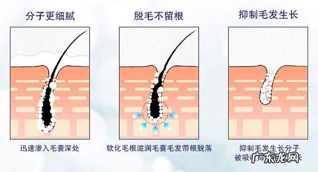 日本最火的脱毛膏 日本有哪些脱毛膏永久不再生毛发