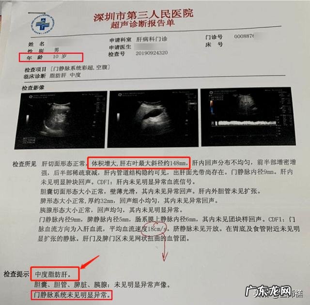 肝变“硬”了,还能扭转吗