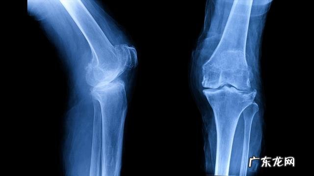 女性更年期,身体很干,有什么好的办法?