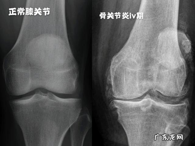女性更年期,身体很干,有什么好的办法?