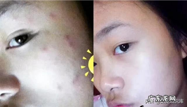 为啥洗脸都能让屏障受损?