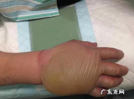 现在流行的网红气球安全吗