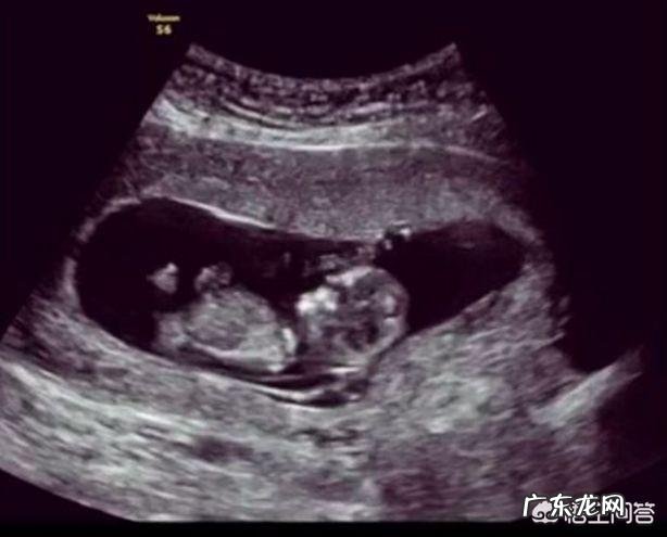 18周的胎儿一般多长时间会胎动一下