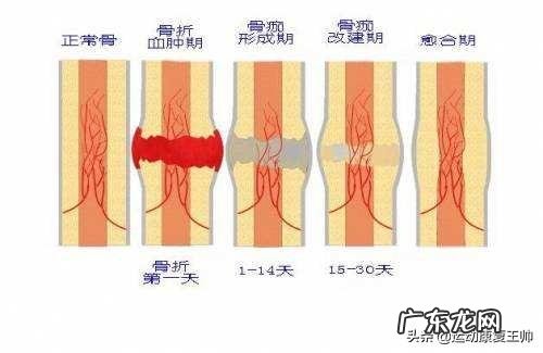 左小腿胫腓骨骨折五十天了,做内髓内钉怎么锻炼?