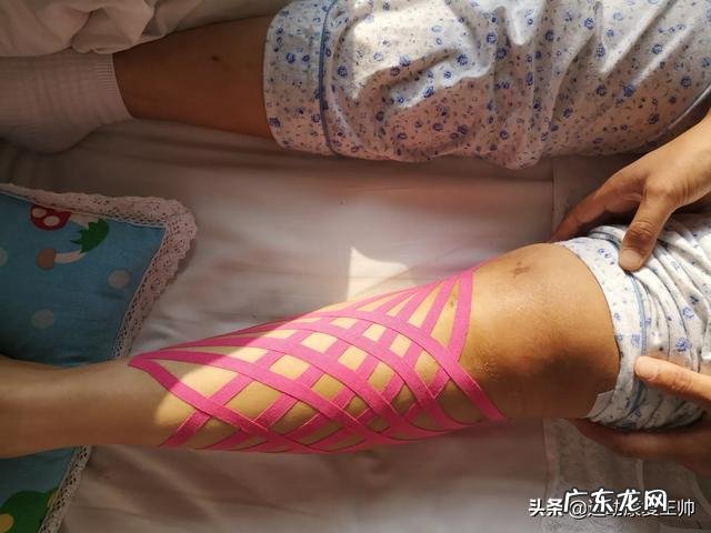 左小腿胫腓骨骨折五十天了,做内髓内钉怎么锻炼?