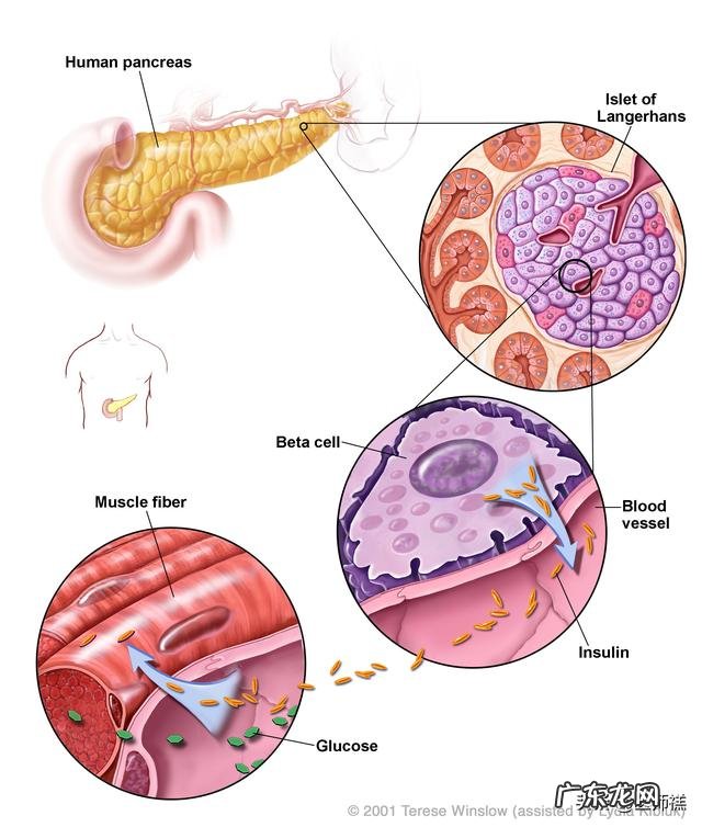 为什么一怀孕,就得糖尿病如何预防妊娠期糖尿病