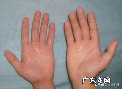 天气变热了手上出汗该怎么办?