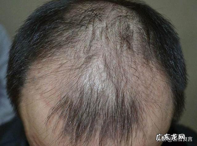 黄花菜有什么营养和功效?