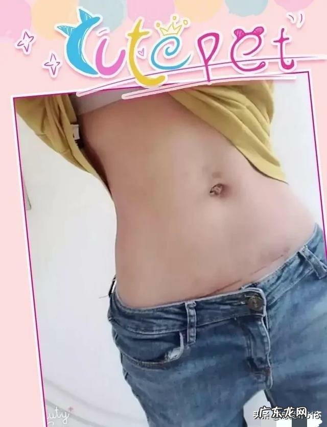 剖腹产后怎么把“大妈”的屁股给拉回来消除大肚腩,从大妈变少女