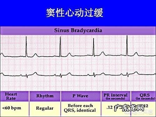 心率过缓的人,适合快走或慢跑吗?
