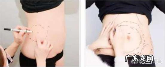 运动不良加速衰老,“减肥妙招”们该如何取舍?