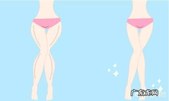 大腿吸脂完,真的有必要换二期的塑身裤吗?