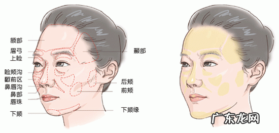扁平疣的患病原因是什么?