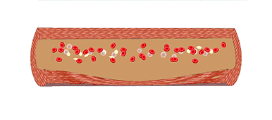 38岁体检量血压,发现高压正常,低压高,怎么回事