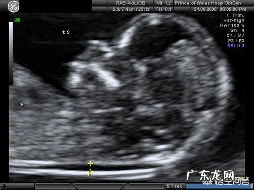 做早期唐氏筛查了,还需要做中期唐氏筛查吗