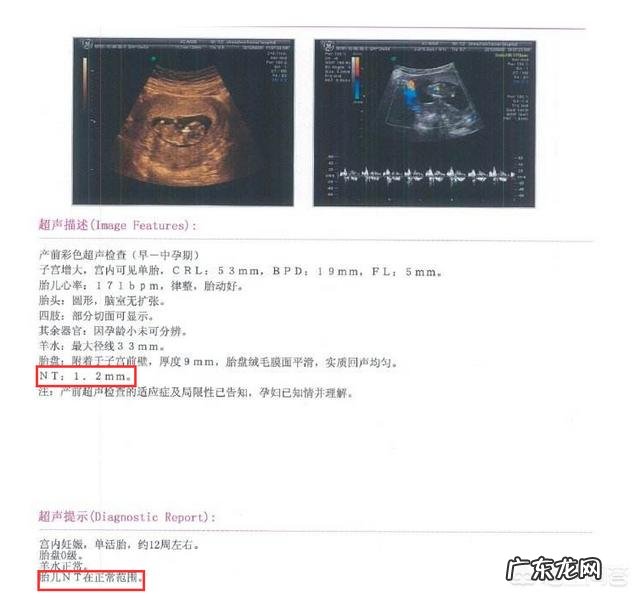 做早期唐氏筛查了,还需要做中期唐氏筛查吗