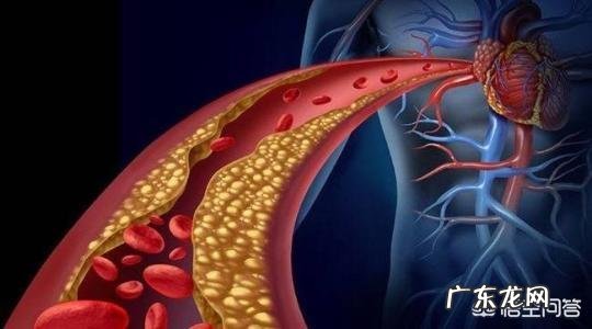 高血糖高血脂高血压俗称三高,三高患者平时应如何注意饮食?