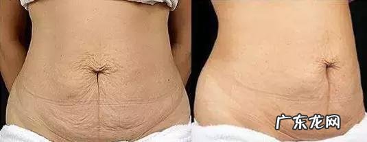 生完孩子怎么快速瘦回100斤?你绝对需要这3招