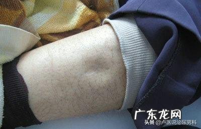 多喝水会减缓慢性肾病患者肾功能下降吗？