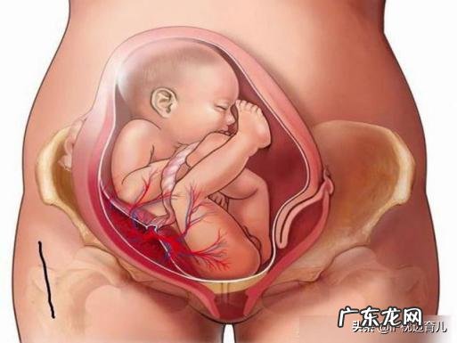 胎儿偏小3周,会推后出生吗?