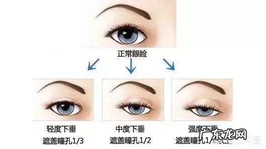 为什么国内现在流行着一股像恐怖洋娃娃那样诡异的整容审美? 什么整容术都比不过国家的特效