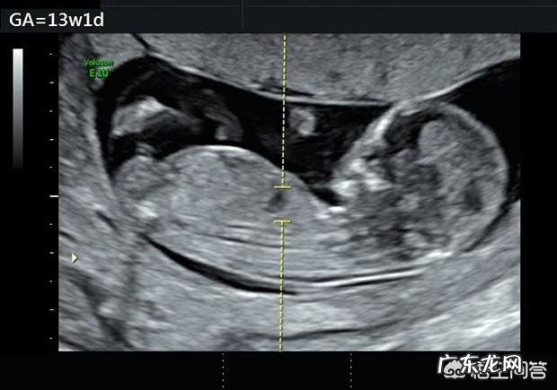 13周的胎儿是什么样的?