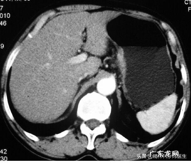 胃肠不好导致的长期恶心，怎么才能改善？