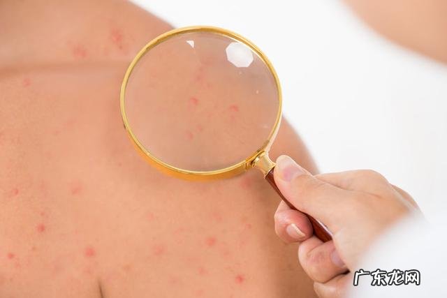 失眠吃什么改善最好,最快