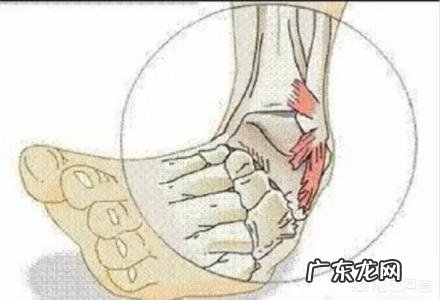 体重较大,膝盖、脚踝都有陈旧伤,如何选择跑鞋?