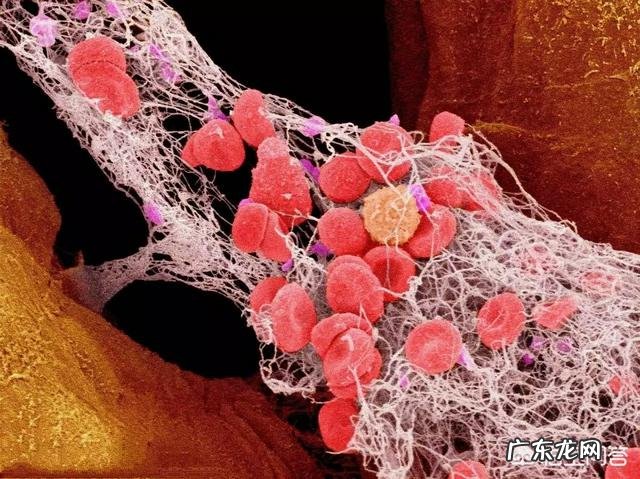 吃素能够预防高血糖高血脂高血压吗?