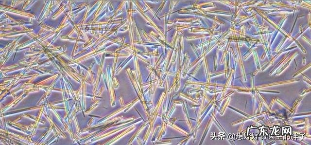 痛风脚肿能用热水泡脚吗有用吗