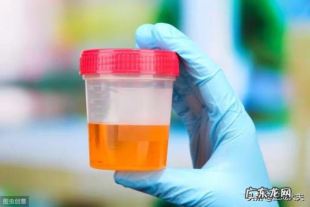 尿检查出潜血有3个加号是怎么回事?