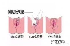 顺产的时候都会撕裂或被侧切吗？