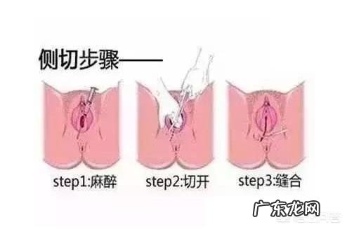 顺产的时候都会撕裂或被侧切吗?