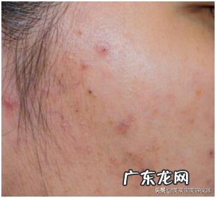 怎么卸妆才正确 只用清水可以卸妆吗