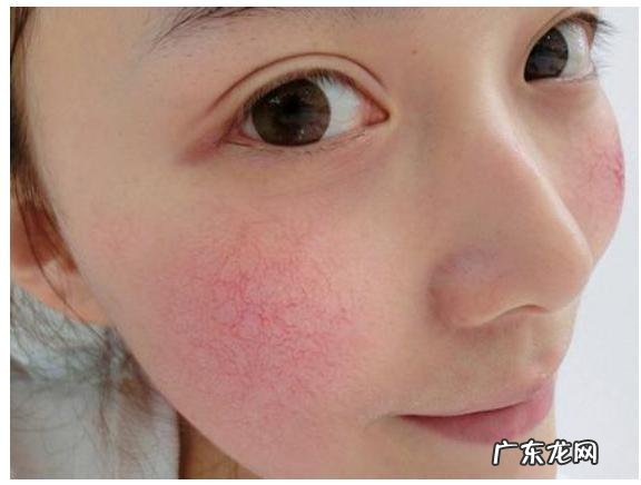 敏感肌肤怎么洗脸 敏感肌肤用什么洗面奶