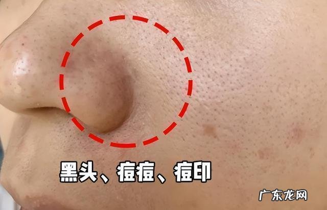 敏感肌肤怎么洗脸 敏感肌肤用什么洗面奶