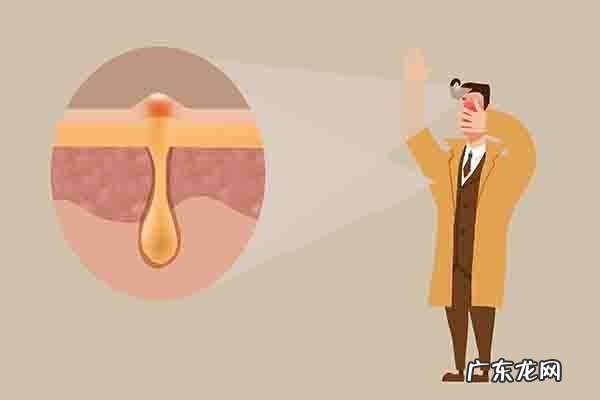 洗脸巾一次性的哪个品牌的最好 关于洗脸有4个误区要避开