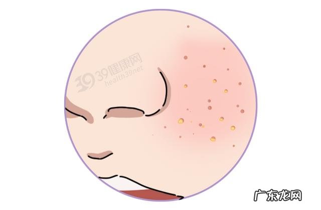 不重视洗脸有什么后果 为什么男士不重视洗脸