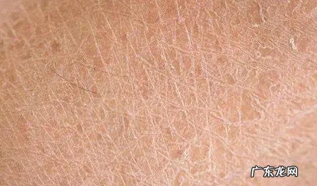 玻尿酸补水 秋冬季皮肤干燥怎么补水